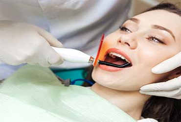  - FREE Teeth Whitening