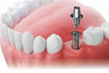 - Free Electric Toothbrush