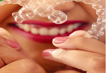  - $1000 OFF on Invisalign