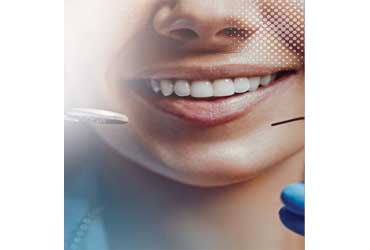  - FREE Teeth Whitening