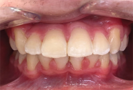 Tooth Harmony Dental Coupon