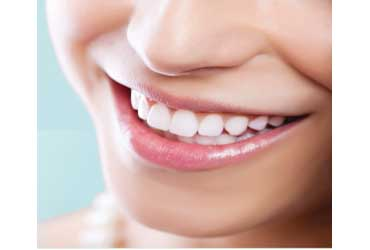 - Cleaning Plus Checkup for $100